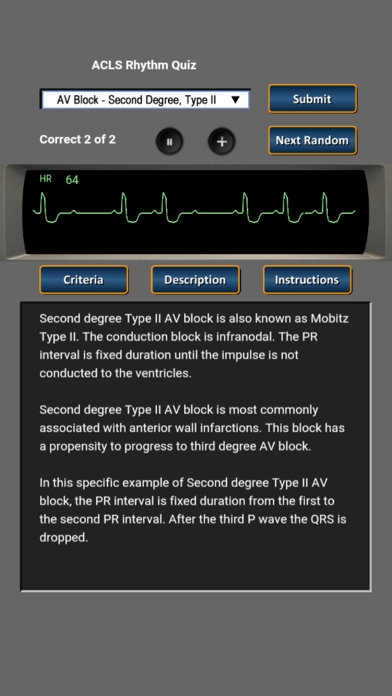 ACLS Rhythm Quiz