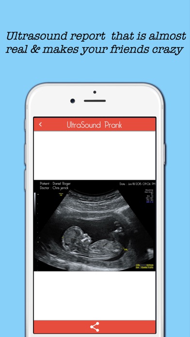 Baby Ultrasound spoof