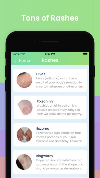 Rash ID - Rash Identifier