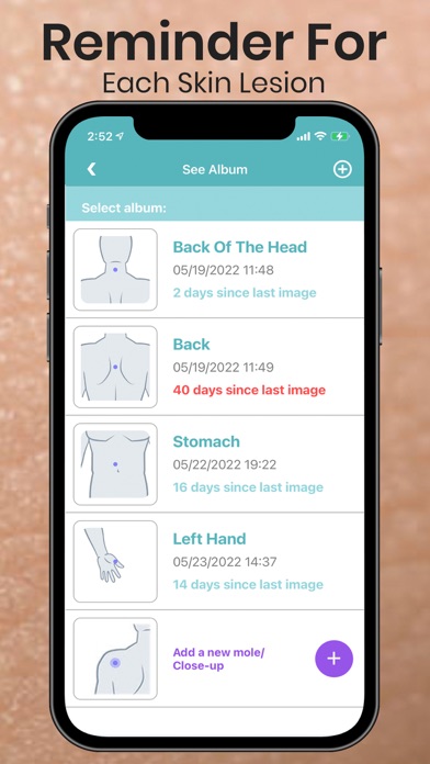 Mole Checker Skin Dermatology