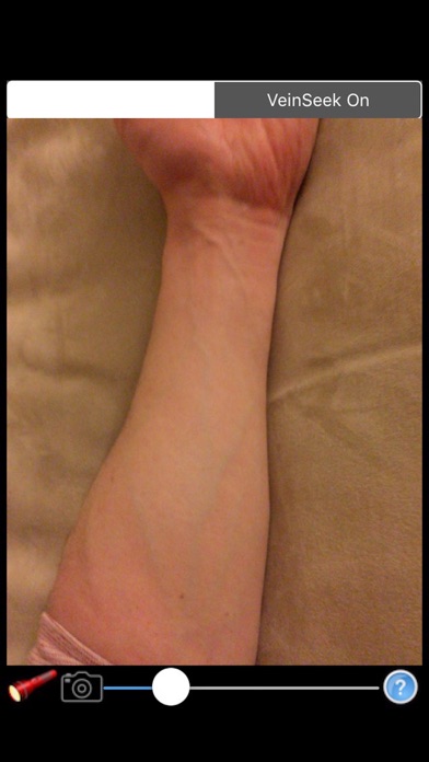VeinSeek Pro