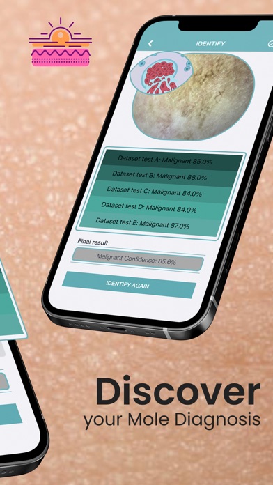 Mole Checker Skin Dermatology