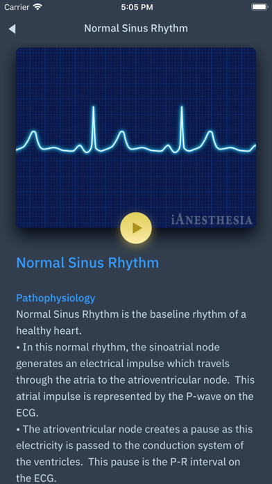 ACLS Rhythms and Quiz