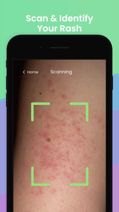 Rash ID - Rash Identifier