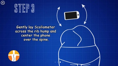 Scoliometer