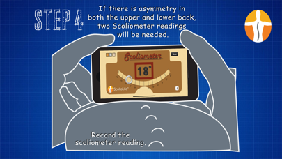 Scoliometer