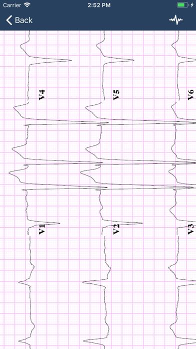 ECG Guide