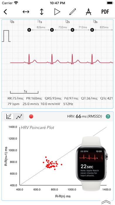 ECG+ Analyzer for HRV and QT