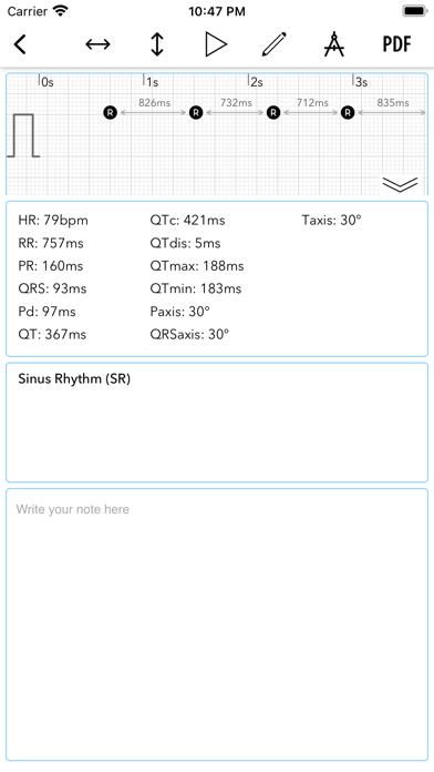 ECG+ Analyzer for HRV and QT