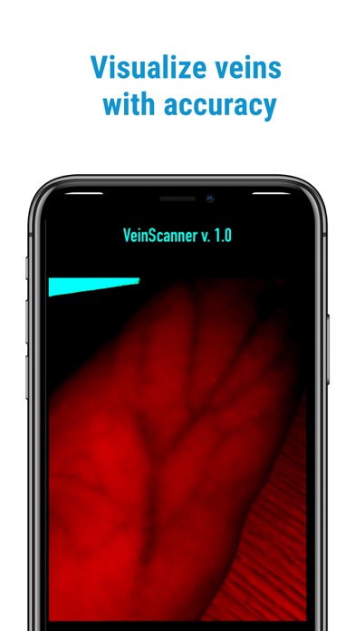 VeinScanner