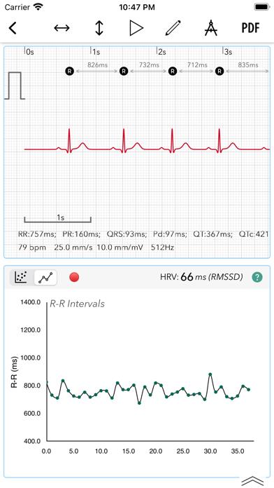 ECG+ Analyzer for HRV and QT
