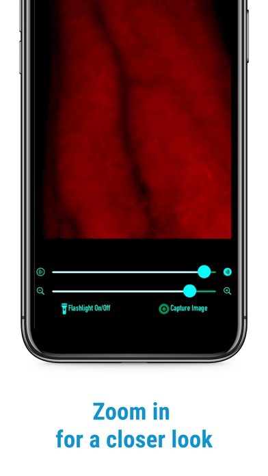 VeinScanner