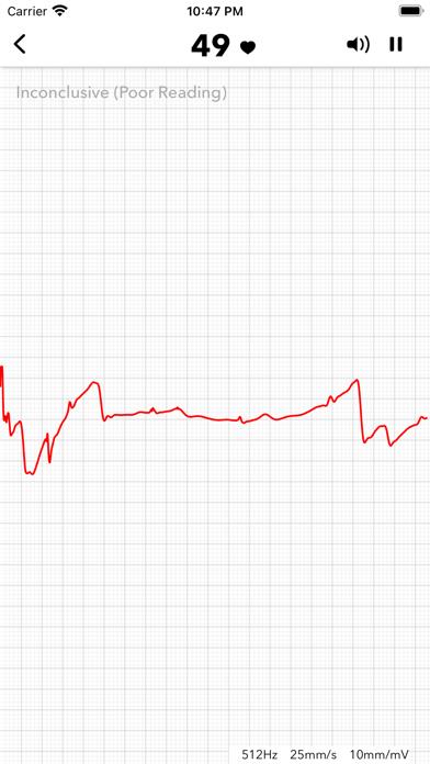 ECG+ Analyzer for HRV and QT
