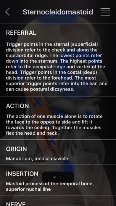 Muscle Trigger Points