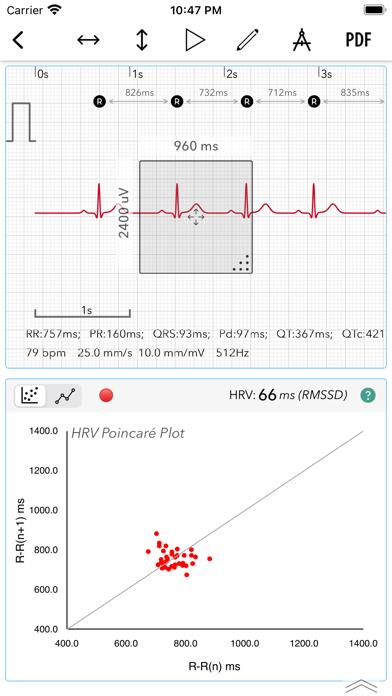 ECG+ Analyzer for HRV and QT