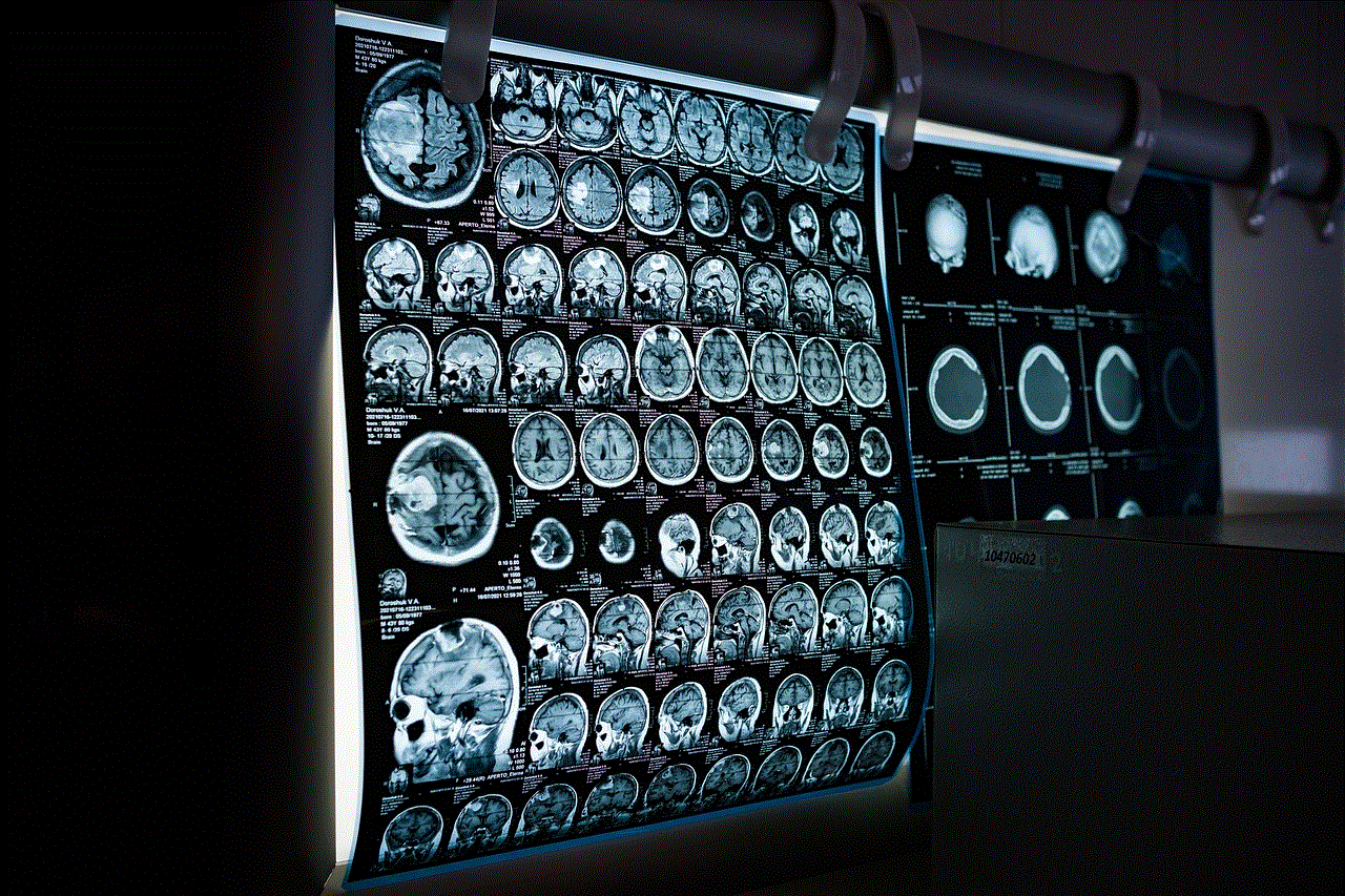 X-Ray Mri